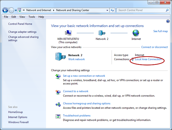 Vista No Network Access